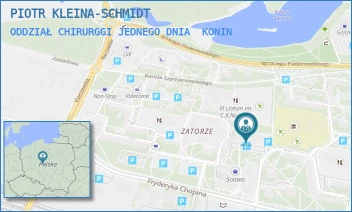 ODDZIAŁ CHIRURGGI JEDNEGO DNIA - PIOTR KLEINA-SCHMIDT - TADEUSZA SZELIGOWSKIEGO 1,  KONIN